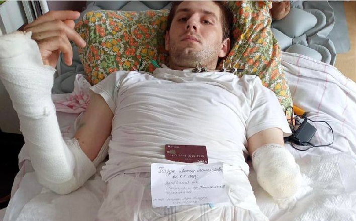 Немає двох ніг та руки: військовий із Черкаської області отримав тяжкі поранення на війні